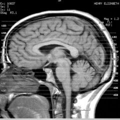 aumentare la memoria